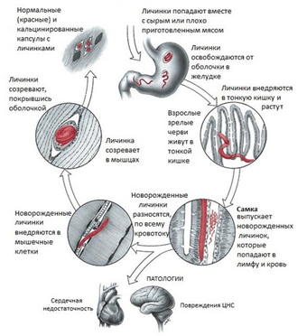 Рис. 5. Жизненный цикл паразитического круглого червя - трихинеллы